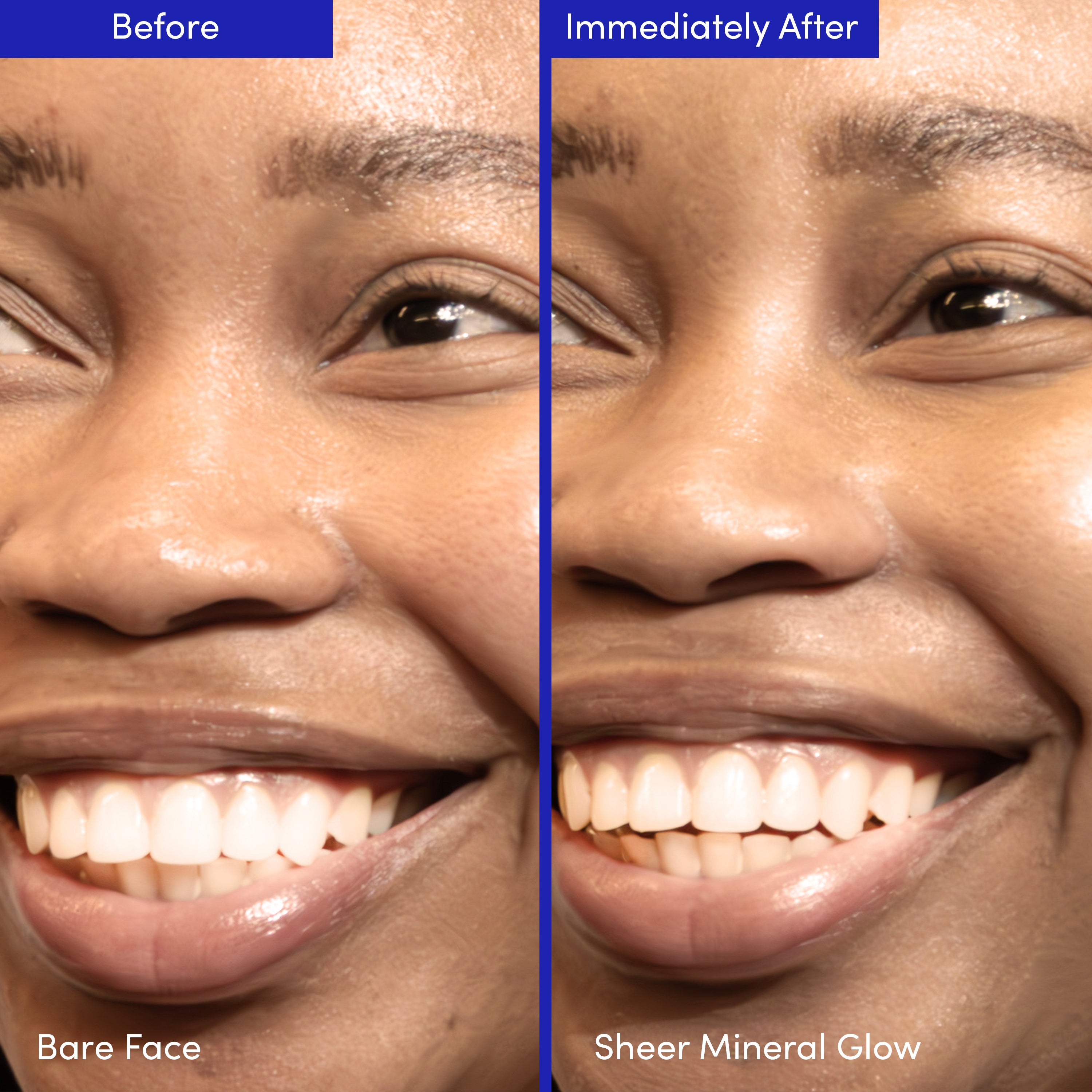Lion Pose Compound SkinInterest skincare set featuring AHA, barrier repair, and SPF products displayed in the image.