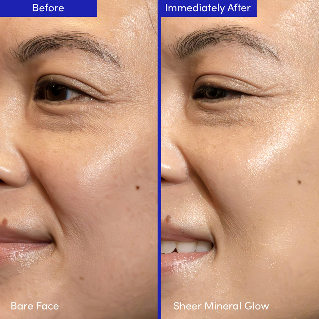 Lion Pose Compound Skinterest skincare set featuring AHA, barrier repair, and SPF products displayed on a clean surface.