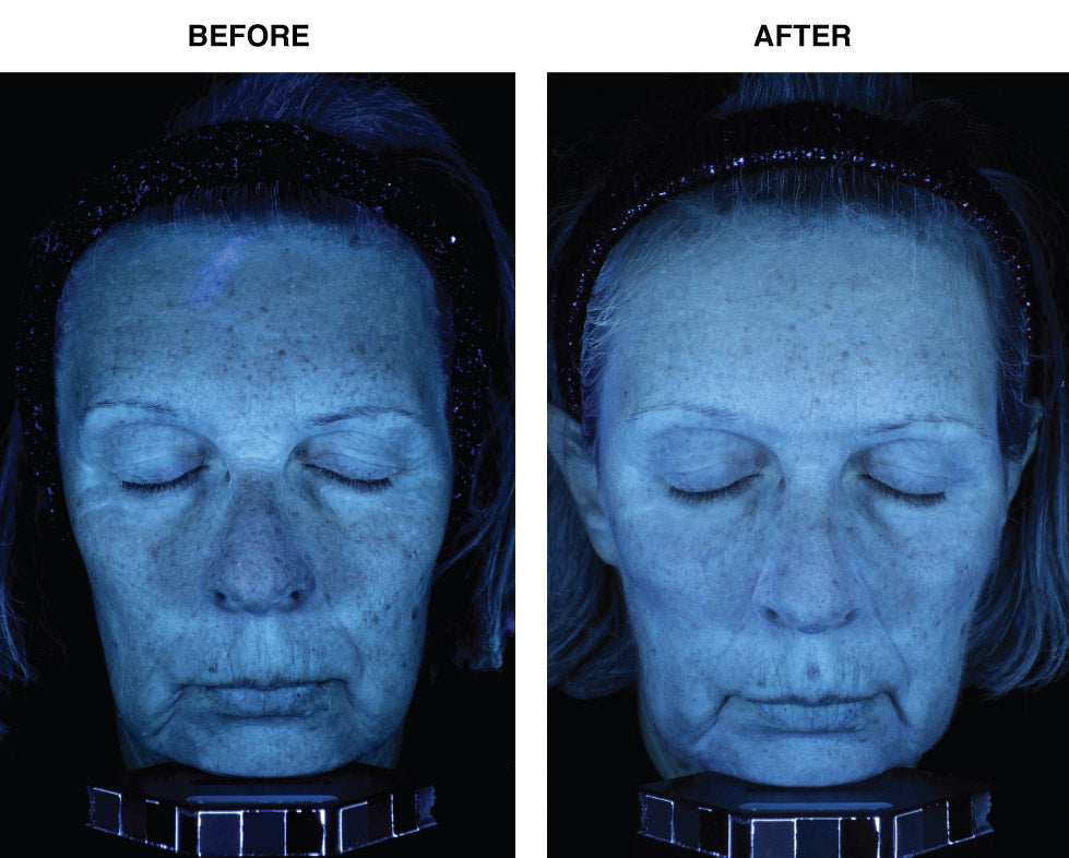 Before and after images showing IDEO Skincare Skin Memory Serum applied to the face, highlighting improved skin texture and brightness.