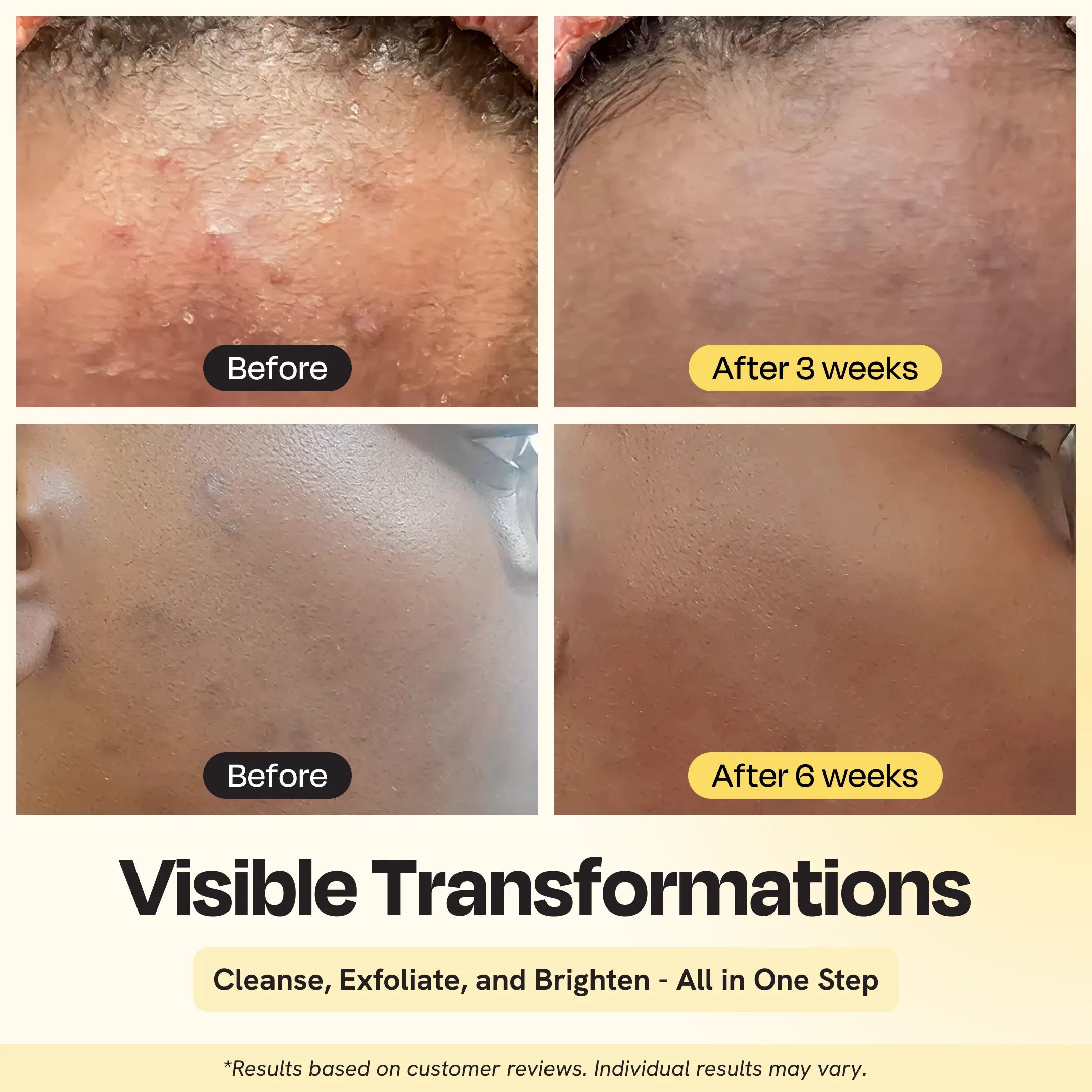 Gleamin Clarifying Brightening Facial Cleanser in a clear bottle with a white and pink label, showing the cleanser's texture.