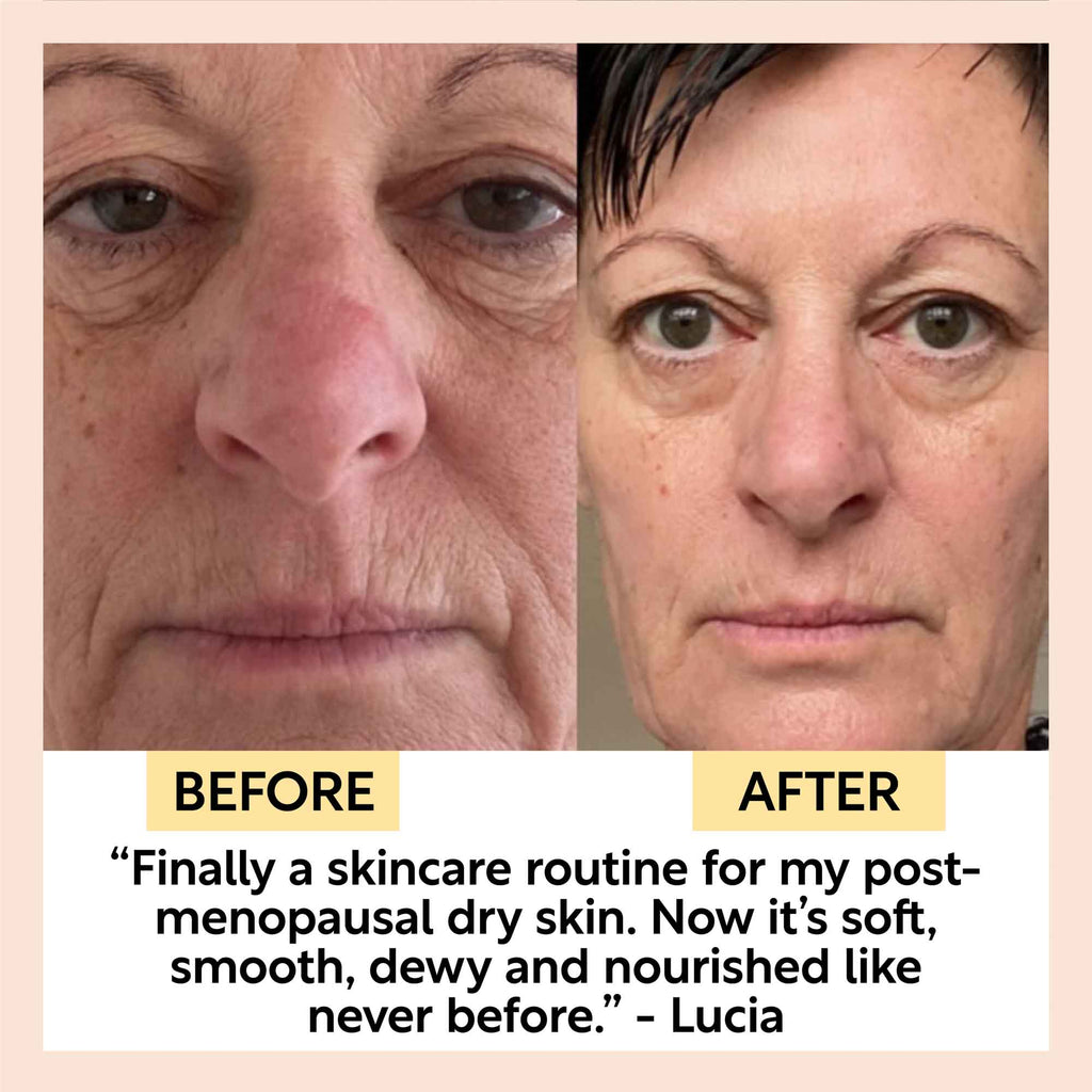 UpCircle anti-aging skincare set with before and after images showing brightened under-eye area and improved skin tone.