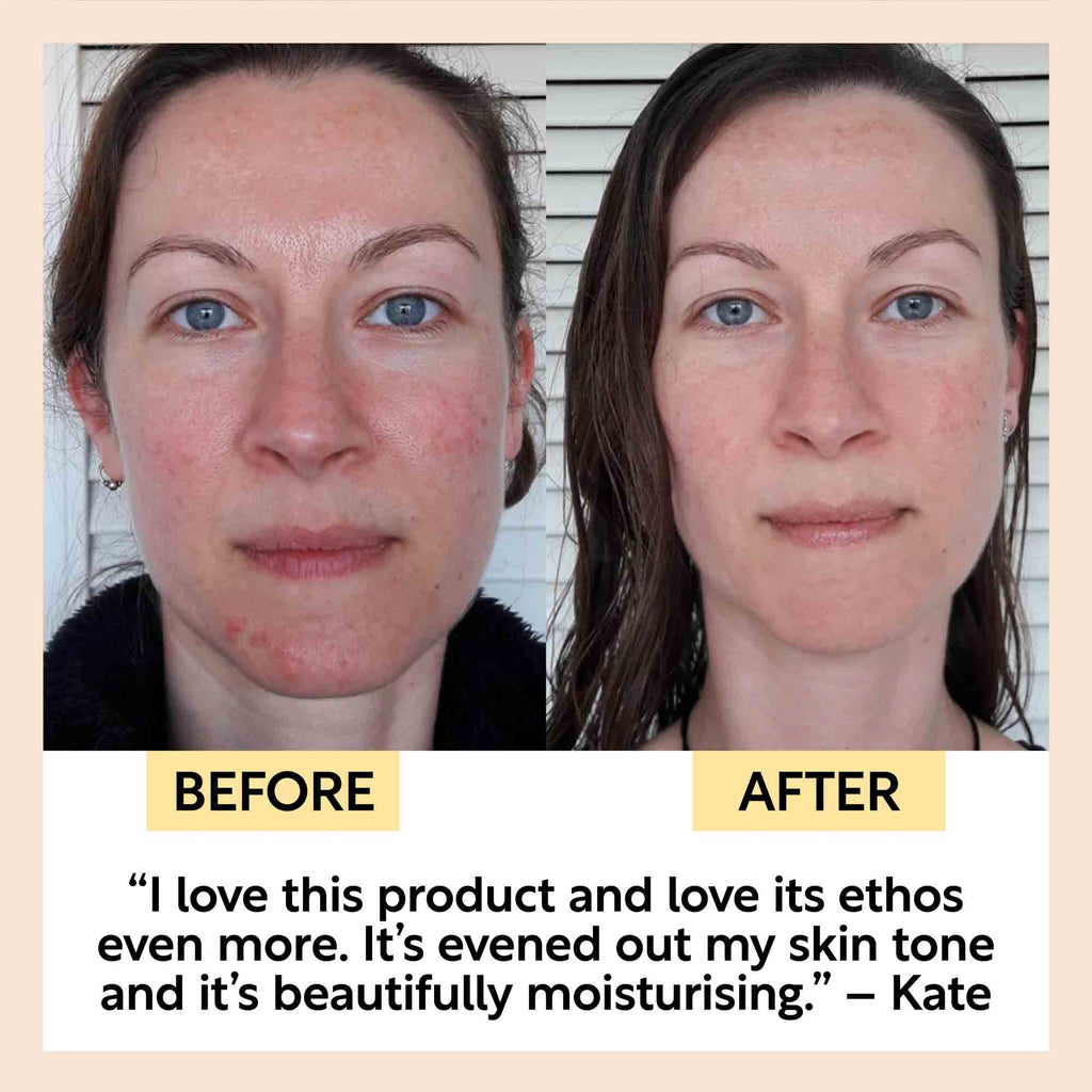 UpCircle anti-aging skincare set with face serum showing before and after complexion improvement.