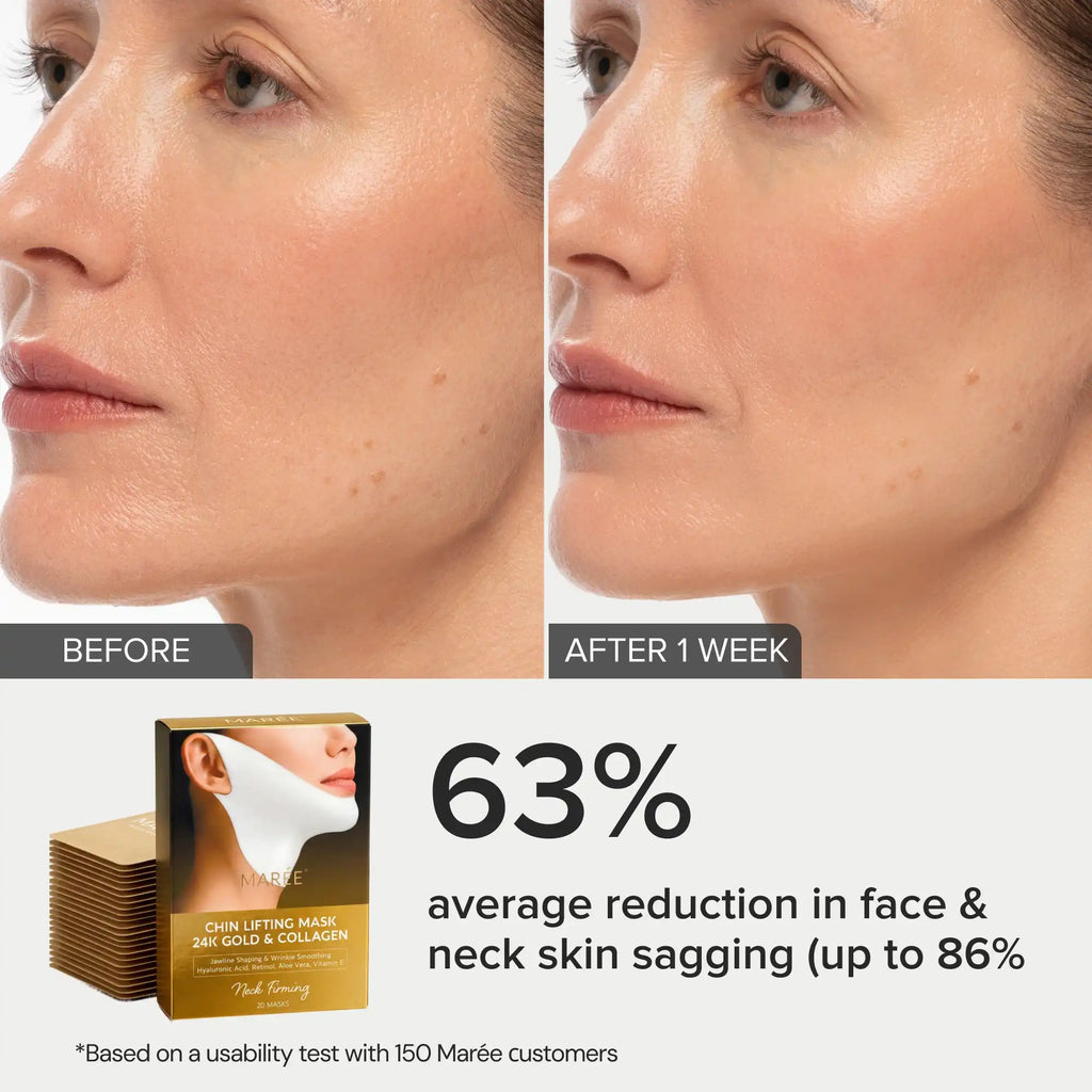 Maree 24K Gold V-Line Lifting Mask treatment pack with 20 face masks showing gold-infused fabric for skin lifting and firming.