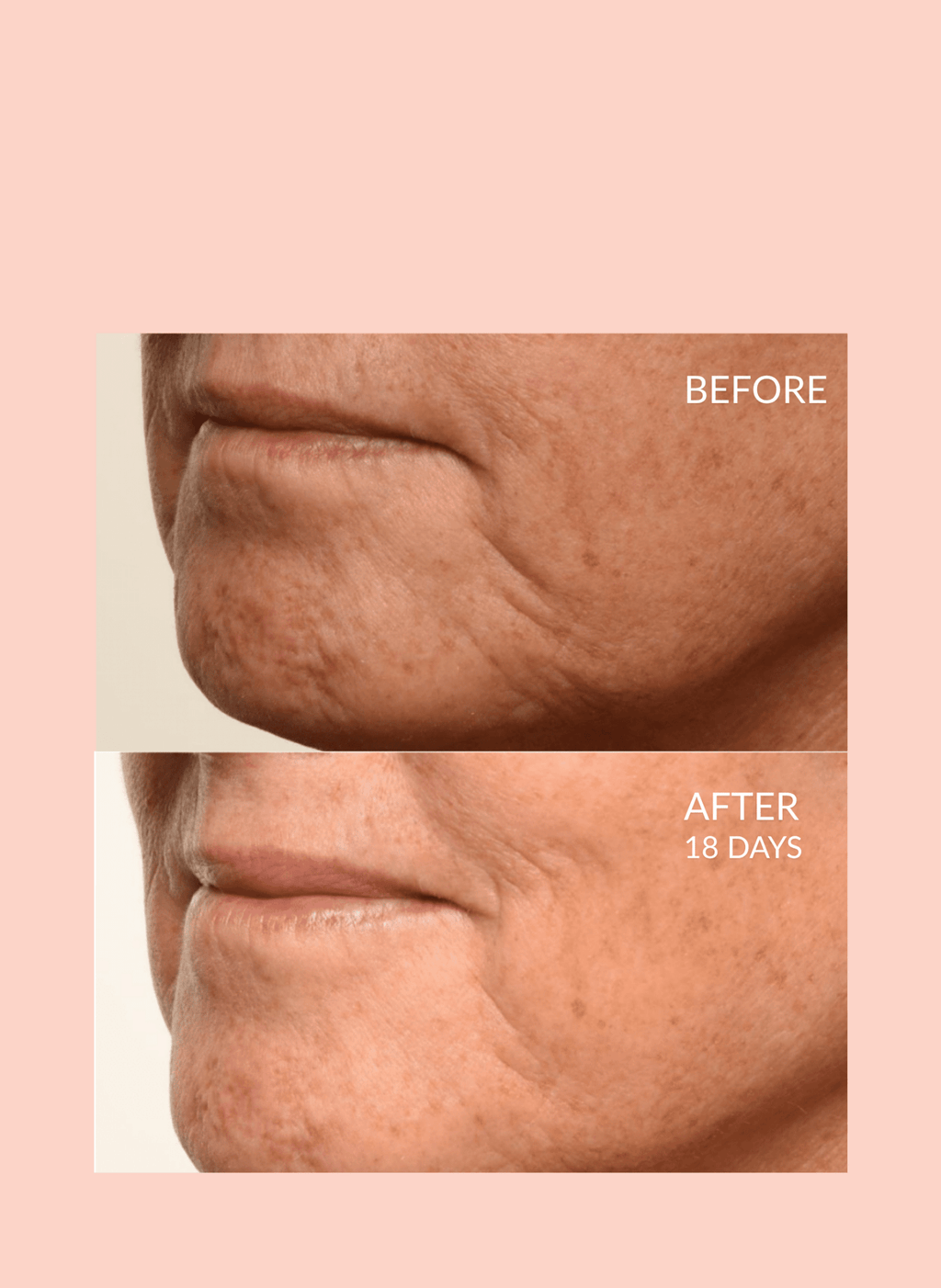 Caire Beauty Theorem Serum Boost in a glass dropper bottle, showcasing the serum's clear, smooth liquid consistency.
