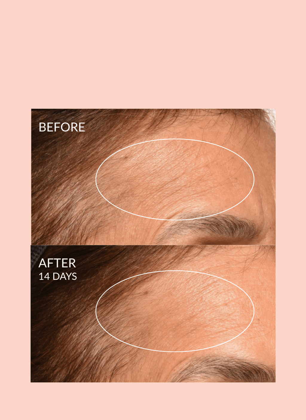 Caire Beauty Theorem Serum Boost in a clear glass dropper bottle, showcasing the nourishing serum inside.