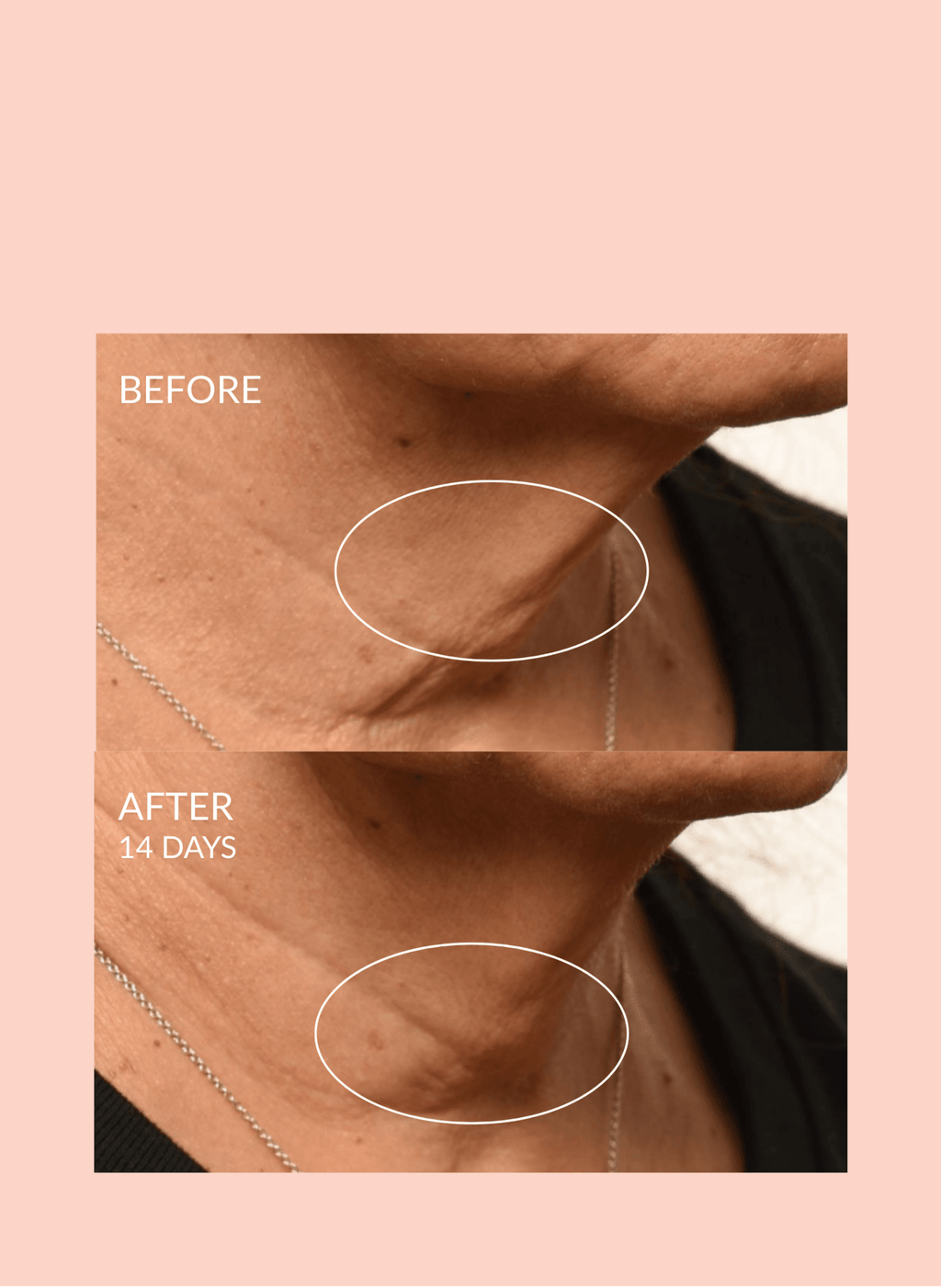 Caire Beauty Theorem Serum Boost bottle with dropper, highlighting its skincare serum container and labeling.